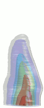 elektrofyzika16a
