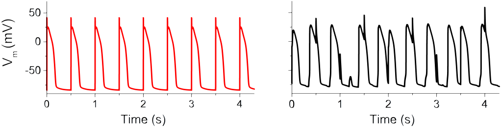 Vliv geneticky podmíněné mutace IKs kanálů na buněčnou elektrickou aktivitu v matematickém modelu; levý graf ukazuje pravidelnou (fyziologickou) aktivitu, pravý graf představuje nepravidelnou (nefyziologickou) aktivitu modelu vyvolanou dysfunkcí kanálů za specifických podmínek (publikováno v Sci. Rep. 2021;11:3573). 